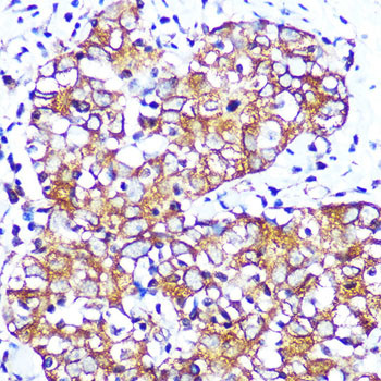 CHRM2 Antibody in Immunohistochemistry (Paraffin) (IHC (P))