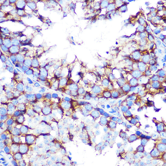 CHRM2 Antibody in Immunohistochemistry (Paraffin) (IHC (P))