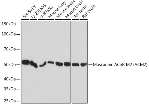 CHRM2 Antibody in Western Blot (WB)