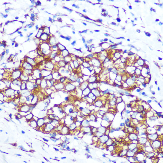 Pannexin 1 Antibody in Immunohistochemistry (Paraffin) (IHC (P))