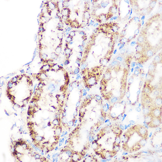 GluD1 Antibody in Immunohistochemistry (Paraffin) (IHC (P))