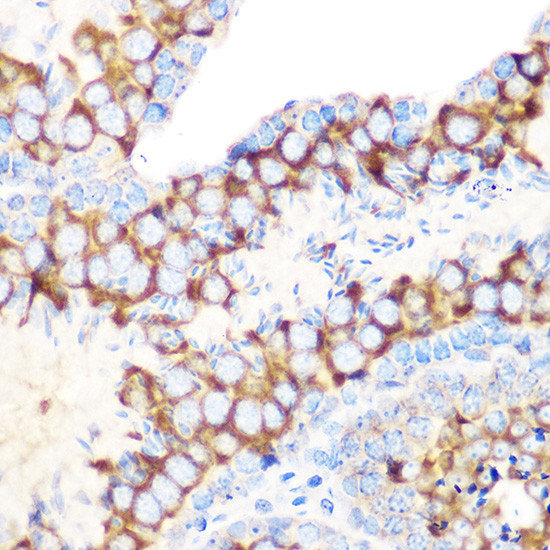 RUVBL1 Antibody in Immunohistochemistry (Paraffin) (IHC (P))