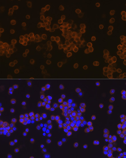 PLCG2 Antibody in Immunocytochemistry (ICC/IF)