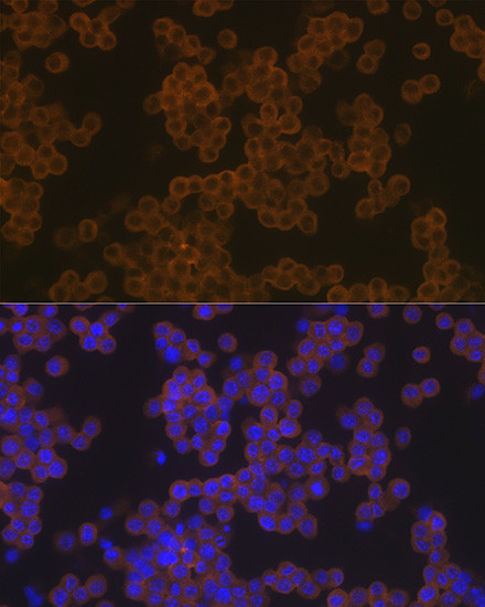 PLCG2 Antibody in Immunocytochemistry (ICC/IF)