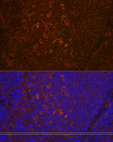 PLCG2 Antibody in Immunohistochemistry (Paraffin) (IHC (P))