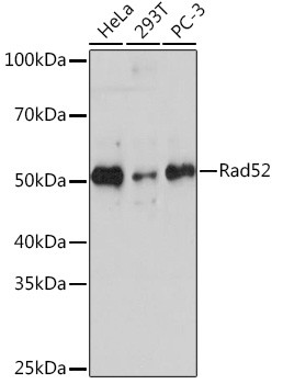 RAD52 Antibody in Western Blot (WB)