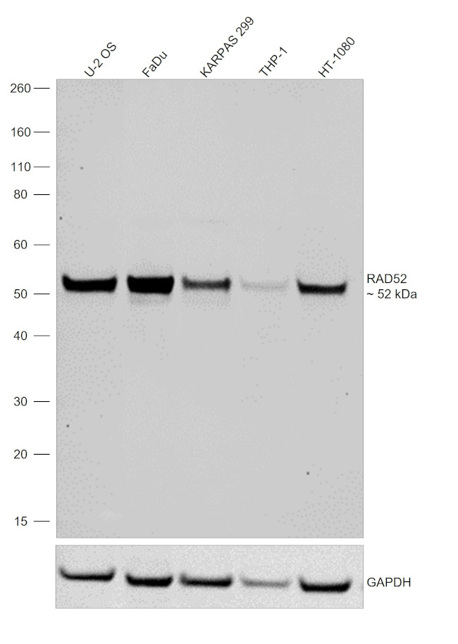 RAD52 Antibody in Western Blot (WB)