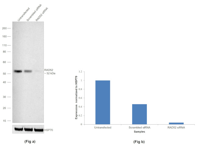 RAD52 Antibody in Western Blot (WB)