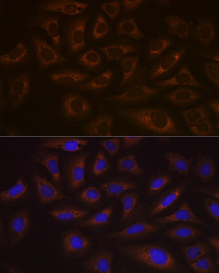 UBE2C Antibody in Immunocytochemistry (ICC/IF)