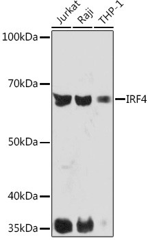 IRF4 Antibody in Western Blot (WB)