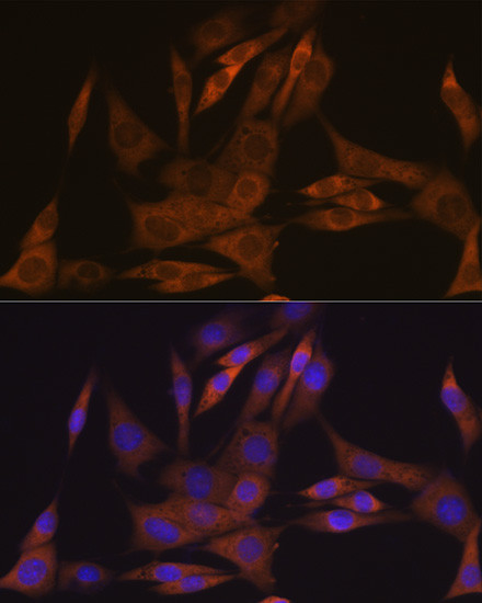 KAP3 Antibody in Immunocytochemistry (ICC/IF)