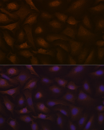 KAP3 Antibody in Immunocytochemistry (ICC/IF)