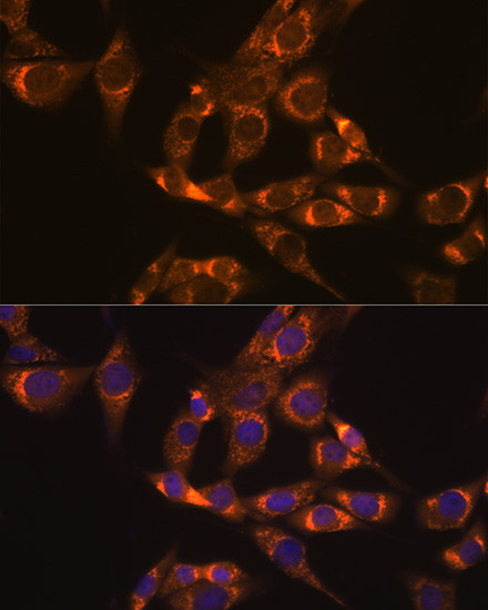 DLD Antibody in Immunocytochemistry (ICC/IF)