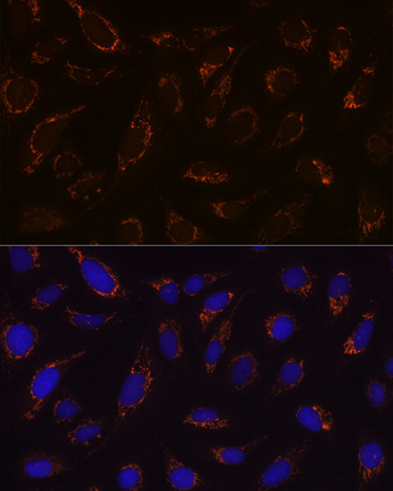 DLD Antibody in Immunocytochemistry (ICC/IF)