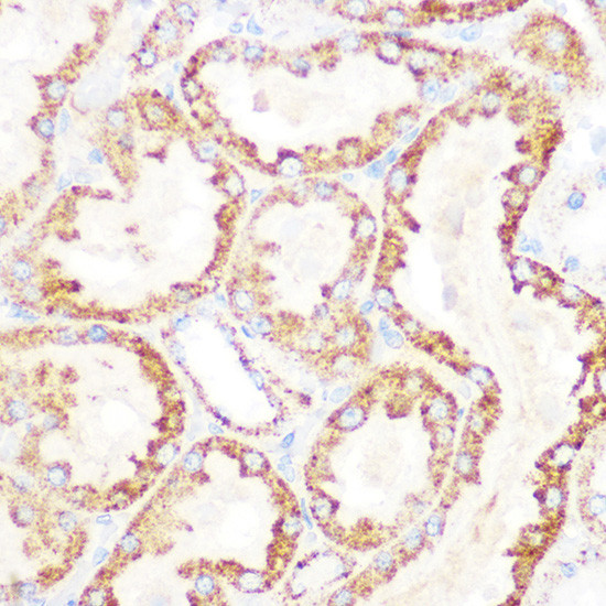 DLD Antibody in Immunohistochemistry (Paraffin) (IHC (P))