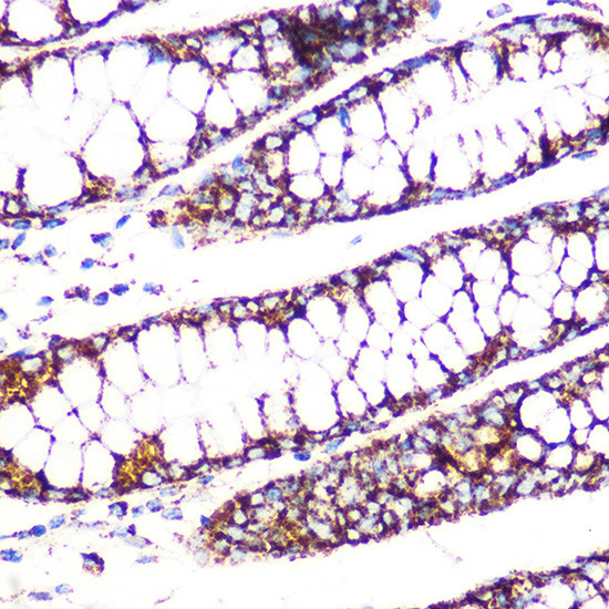 DLD Antibody in Immunohistochemistry (Paraffin) (IHC (P))