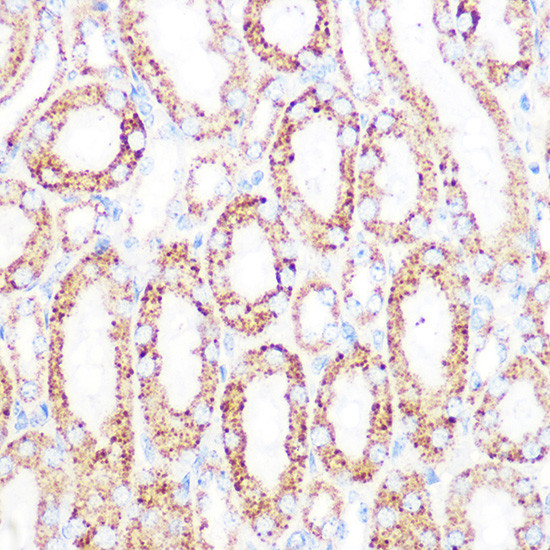 DLD Antibody in Immunohistochemistry (Paraffin) (IHC (P))