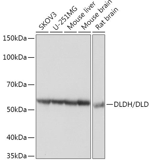 DLD Antibody in Western Blot (WB)