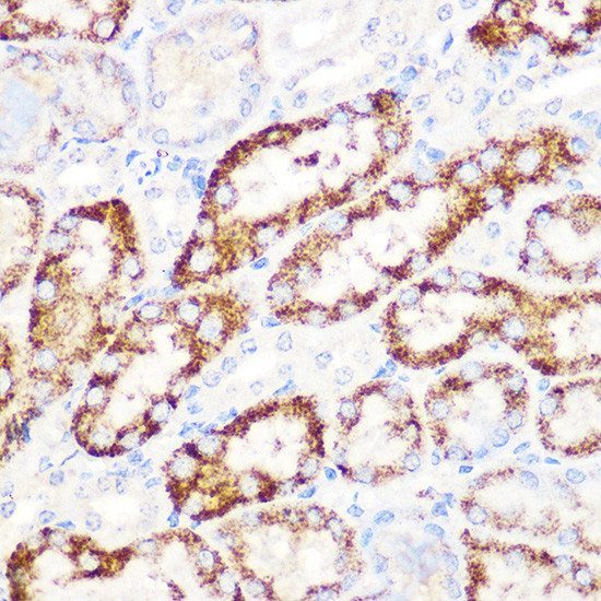 ANGPTL3 Antibody in Immunohistochemistry (Paraffin) (IHC (P))