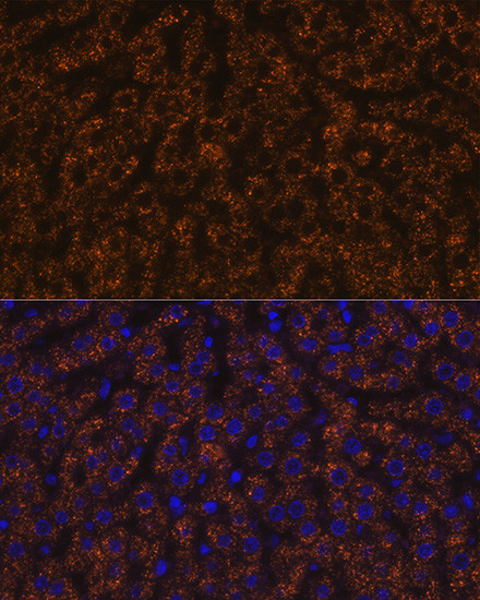 ANGPTL3 Antibody in Immunohistochemistry (Paraffin) (IHC (P))