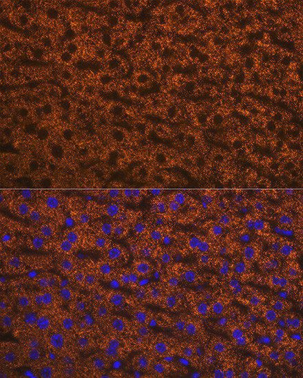 ANGPTL3 Antibody in Immunohistochemistry (Paraffin) (IHC (P))