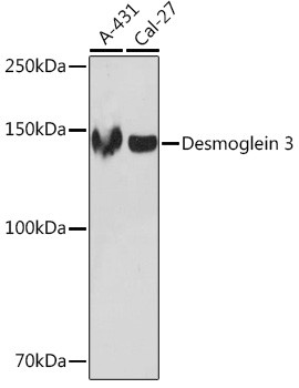 Desmoglein 3 Antibody in Western Blot (WB)