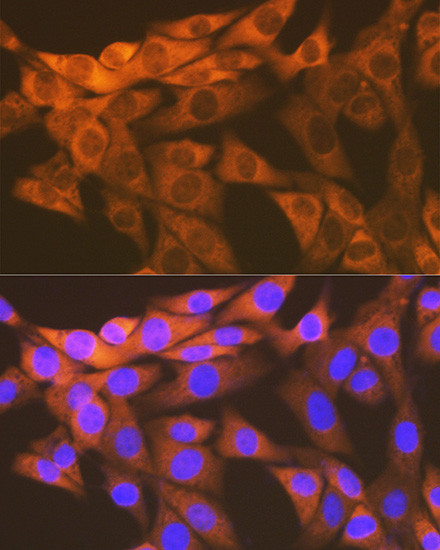 HSPE1 Antibody in Immunocytochemistry (ICC/IF)