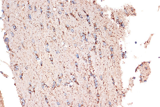 HSPE1 Antibody in Immunohistochemistry (Paraffin) (IHC (P))