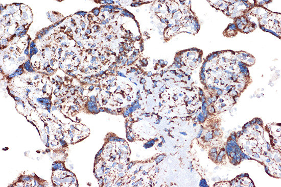 HSPE1 Antibody in Immunohistochemistry (Paraffin) (IHC (P))