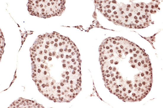 DDX17 Antibody in Immunohistochemistry (Paraffin) (IHC (P))