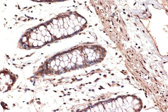 DDX17 Antibody in Immunohistochemistry (Paraffin) (IHC (P))