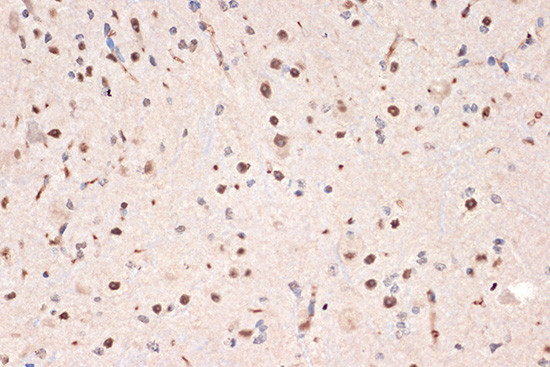 DDX17 Antibody in Immunohistochemistry (Paraffin) (IHC (P))