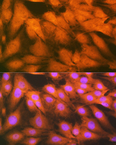 FGF1 Antibody in Immunocytochemistry (ICC/IF)