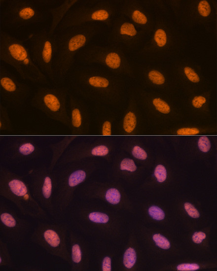 JMJD2B Antibody in Immunocytochemistry (ICC/IF)