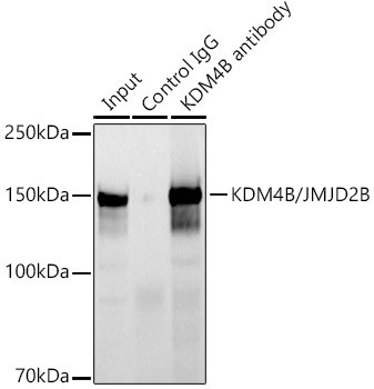 JMJD2B Antibody in Immunoprecipitation (IP)