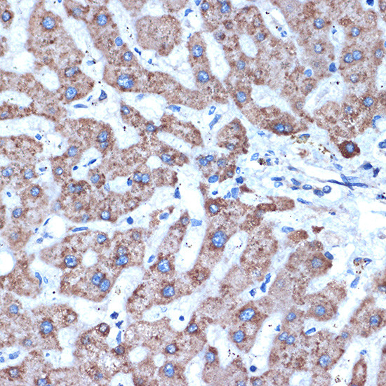 ADAM15 Antibody in Immunohistochemistry (Paraffin) (IHC (P))