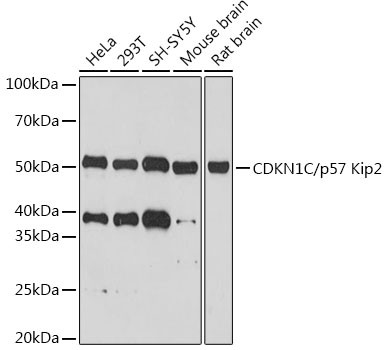 p57 Kip2 Antibody in Western Blot (WB)