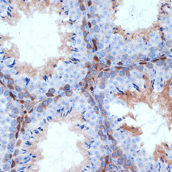 PKC delta Antibody in Immunohistochemistry (Paraffin) (IHC (P))