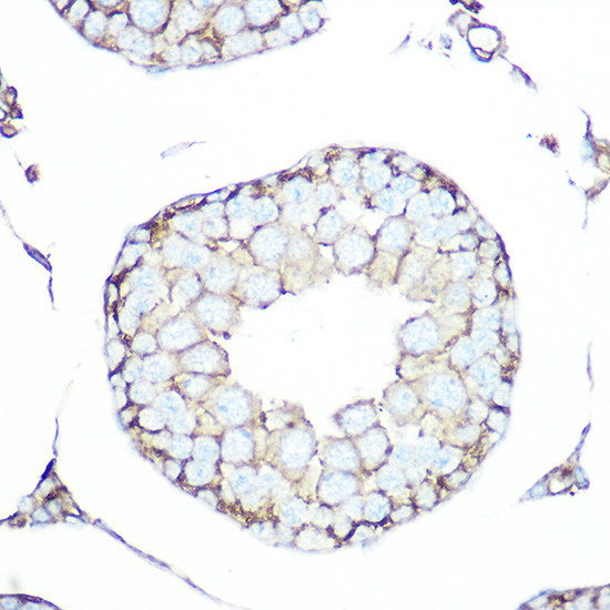 SSTR5 Antibody in Immunohistochemistry (Paraffin) (IHC (P))