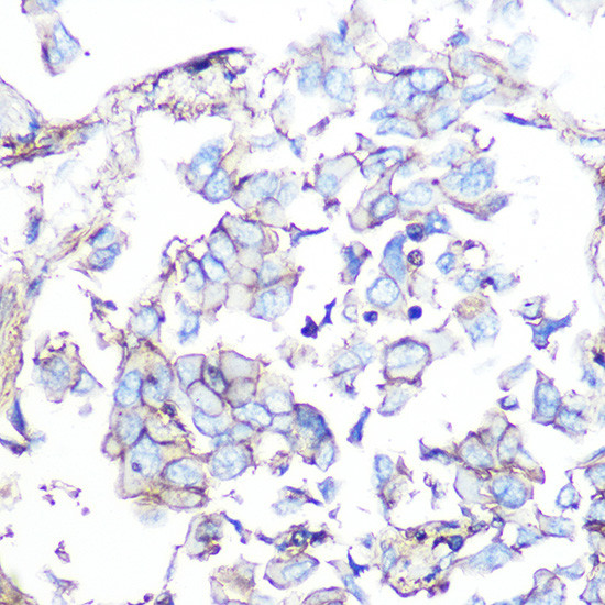 SSTR5 Antibody in Immunohistochemistry (Paraffin) (IHC (P))