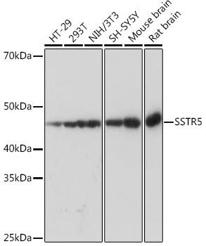 SSTR5 Antibody in Western Blot (WB)