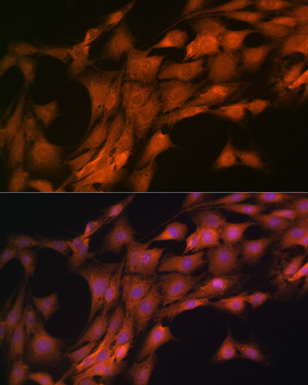 FKBP8 Antibody in Immunocytochemistry (ICC/IF)