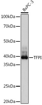 TFPI Antibody in Western Blot (WB)