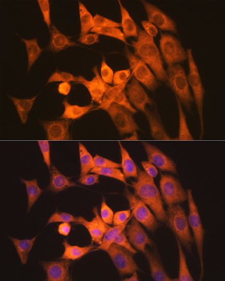 Calpain 1 Antibody in Immunocytochemistry (ICC/IF)