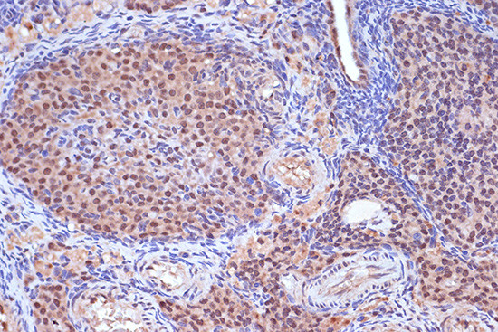 MSH2 Antibody in Immunohistochemistry (Paraffin) (IHC (P))