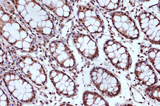 MSH2 Antibody in Immunohistochemistry (Paraffin) (IHC (P))