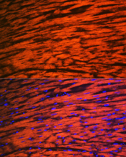 MYL2 Antibody in Immunohistochemistry (Paraffin) (IHC (P))