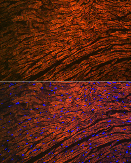 MYL2 Antibody in Immunohistochemistry (Paraffin) (IHC (P))