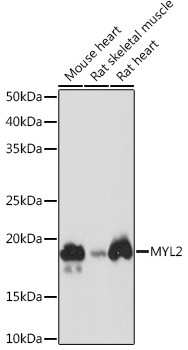 MYL2 Antibody in Western Blot (WB)