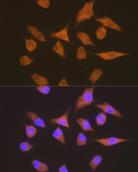 EEF1G Antibody in Immunocytochemistry (ICC/IF)